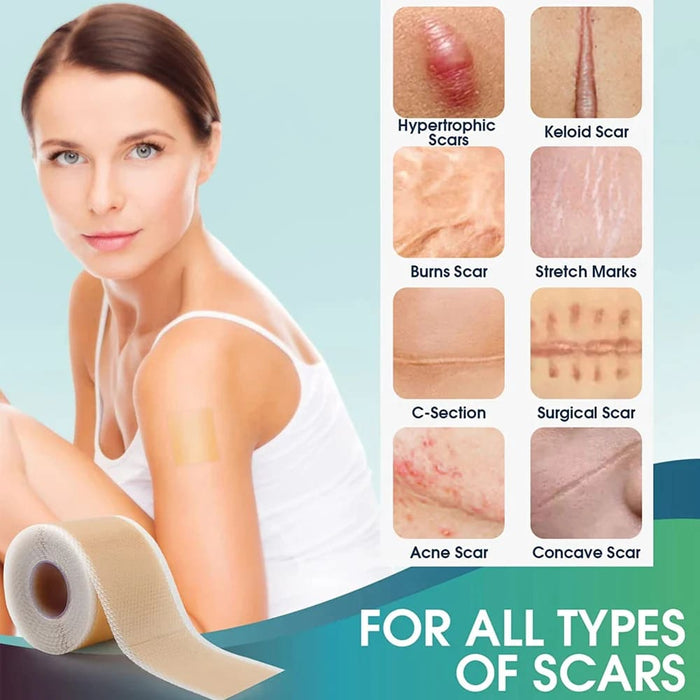 1roll Reusable Professional Silicone Scar Strips For Keloid