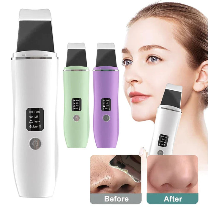 Deep Clean Ultrasonic Skin Scrubber For Face