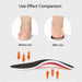 Mens Ortic Insoles For Flat Feet Relief