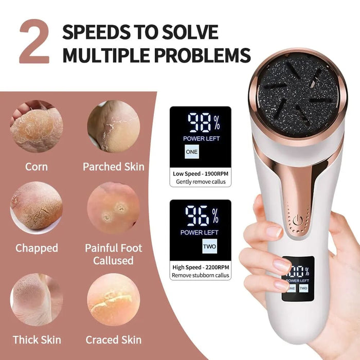 Portable Electric Foot Callus Remover