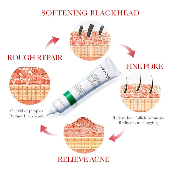 Salicylic Acid Acne Mark Repair Firming Moisturizing