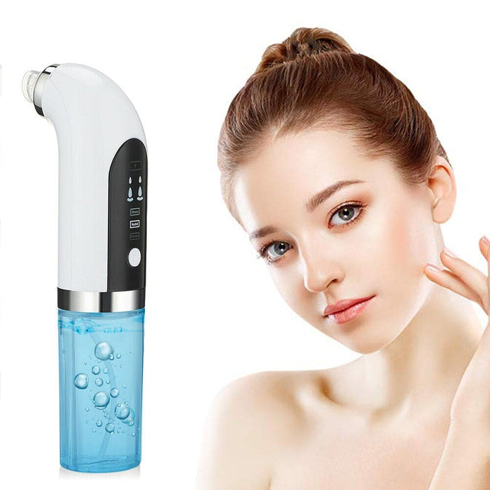 Vibe Geeks Usb Rechargeable Electric Pore Blackhead Vacuum