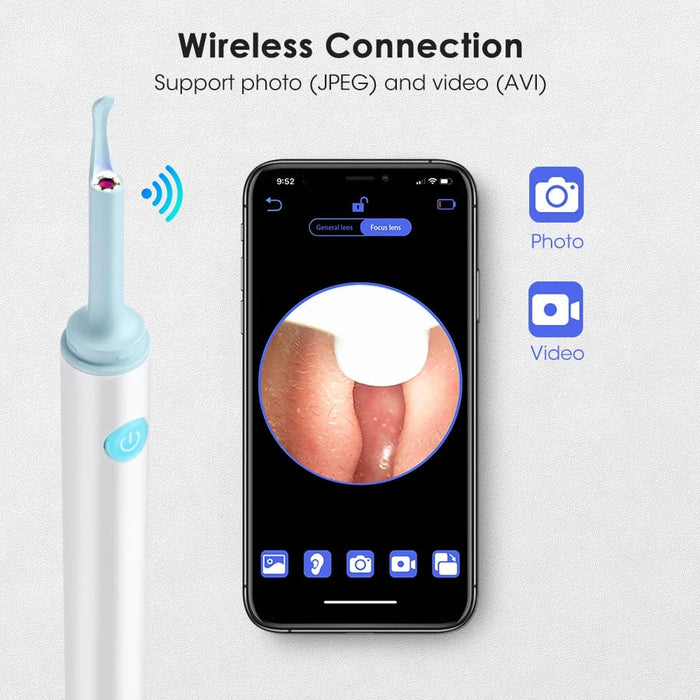 Wifi Ear Cleaner With Led Light And Safe Silicone Spoon